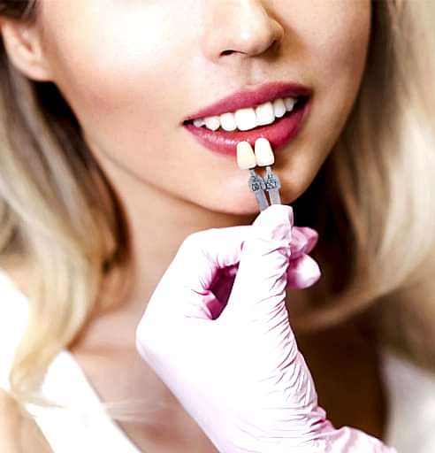 Cappadocia Zirconium Dental Veneers - Daily Examination