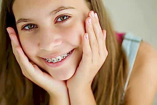 Turkey Orthodontic Braces Treatment 1Days