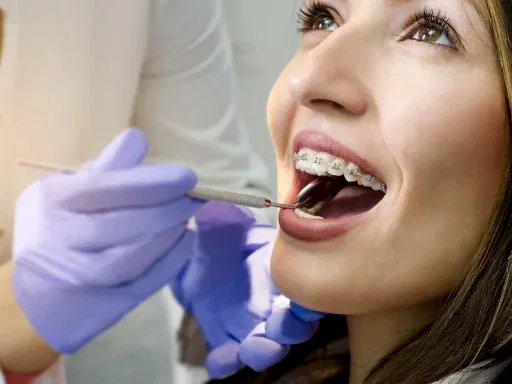 Turkey Orthodontic Braces Treatment 1Day